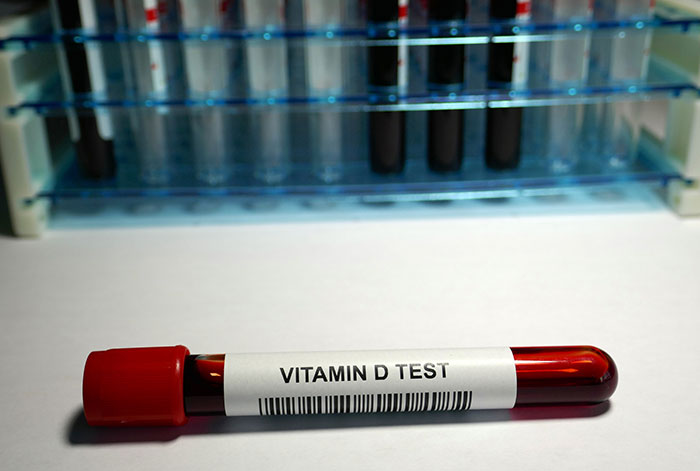 Don’t Let an Underactive Thyroid Steal Your Sunshine
